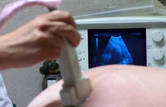 Heloiza Bomtempo - Foto 1