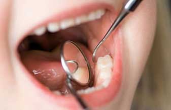 Giuliana Bru Carella - Foto 1